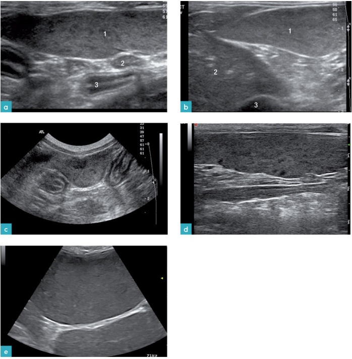患有淋巴瘤的公猫脾脏二维影像 患有淋巴瘤的公猫脾脏二维影像