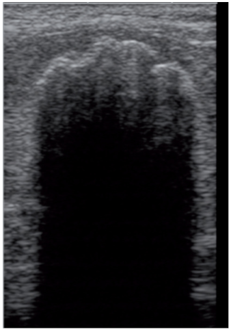 一只16岁公猫的脾脏二维影像 一只16岁公猫的脾脏二维影像