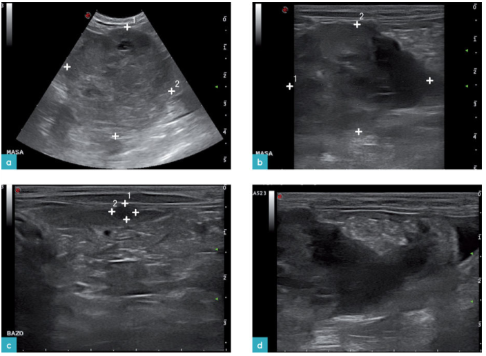 一只12岁公猫左侧前腹部一个巨大的,回声不均匀的腹部肿块 一只12岁公猫左侧前腹部一个巨大的,回声不均匀的腹部肿块
