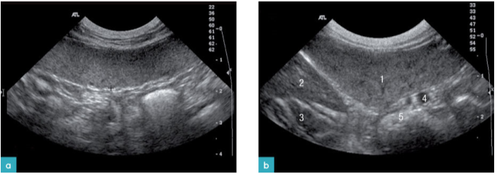 11岁患有三体炎的短毛家猫的脾脏的二维影像 11岁患有三体炎的短毛家猫的脾脏的二维影像