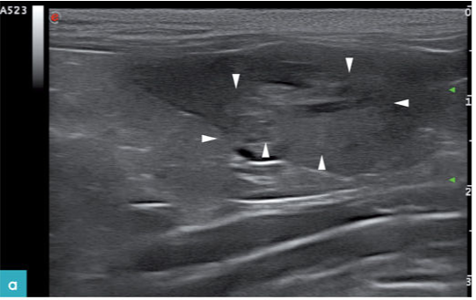 成年母猫的脾脏影像 成年母猫的脾脏影像