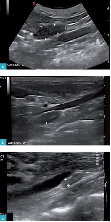 健康猫的左侧肾上腺矢状面