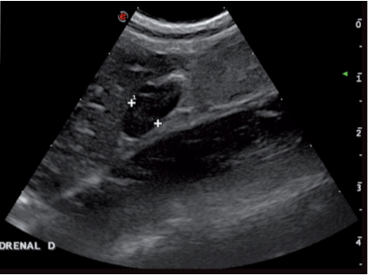 甲状腺功能亢进的患猫的右侧肾上腺矢状面