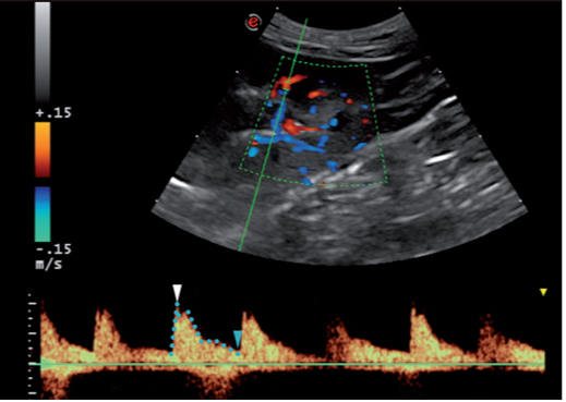 健康猫的肾脏双功能多普勒图像 健康猫的肾脏双功能多普勒图像