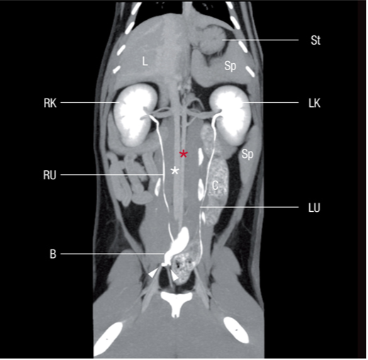 背侧CT重建健康猫的腹部,采用静脉内输注碘对比照影剂 背侧CT重建健康猫的腹部,采用静脉内输注碘对比照影剂