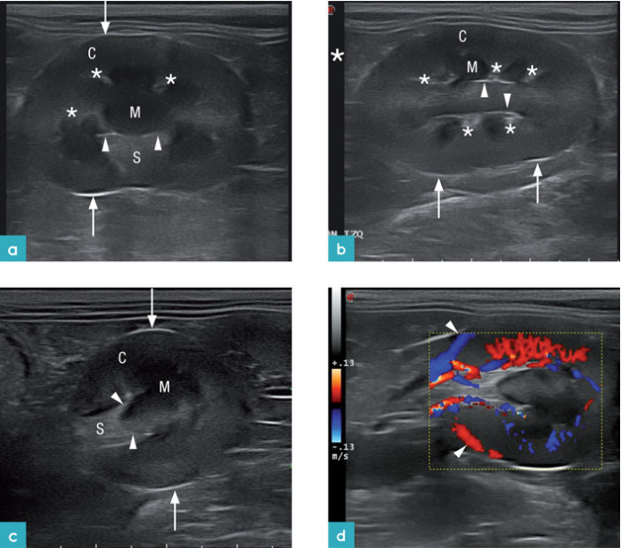 健康公猫的肾脏 健康公猫的肾脏