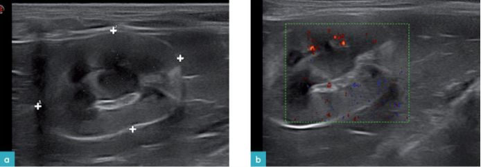 八岁雌性猫左肾的纵向视图
