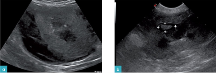 术后肾活检后,具有急性肾损伤雄性猫 术后肾活检后,具有急性肾损伤雄性猫