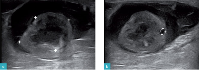 11岁雄性慢性肾脏病的猫 11岁雄性慢性肾脏病的猫