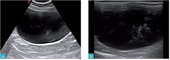 脂肪尿，一只健康雄性猫的膀胱矢状面。