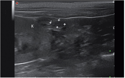 一只处于间情期的九岁母猫的卵巢