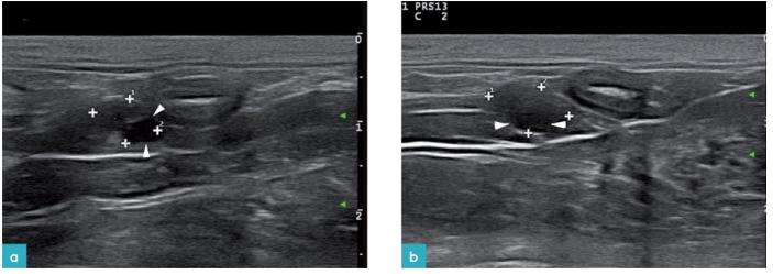 一只处于发情期的7岁母猫右肾和左侧卵巢