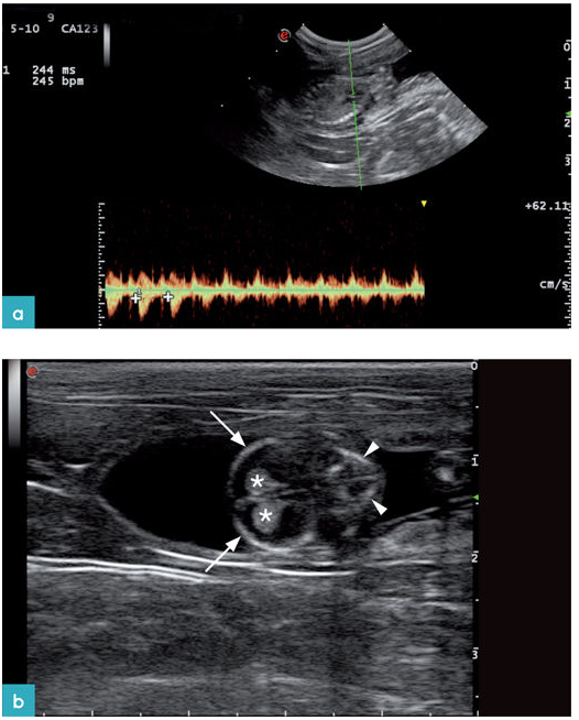 胎龄大于28天的胎儿脉冲多普勒超声图像，取样框的位置在心脏。
