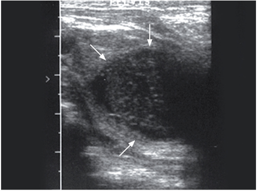 一只患有前列腺脓肿的7岁雄性暹罗猫。