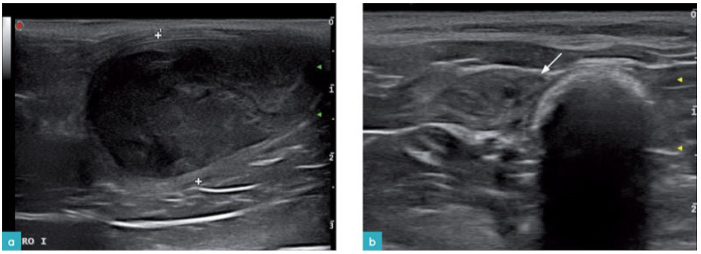 一只7岁母猫的左侧子宫角及子宫体附近区域。