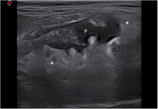 一只高楼坠落的公猫，一线的回声不均匀