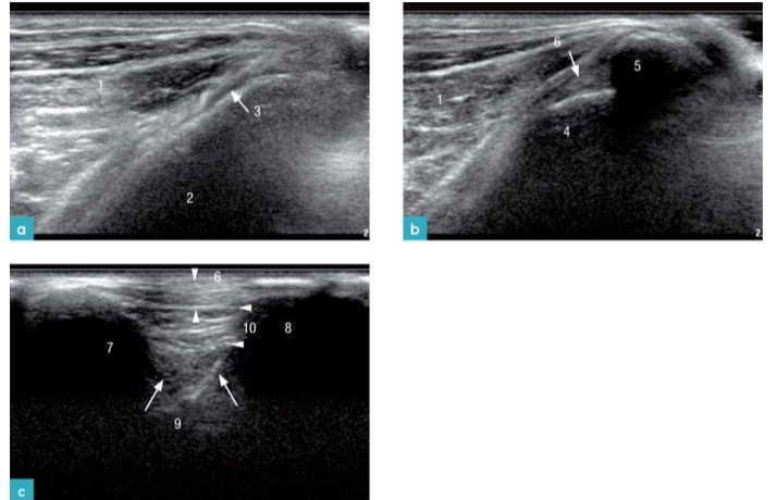 一只健康公猫的膝关节矢状面