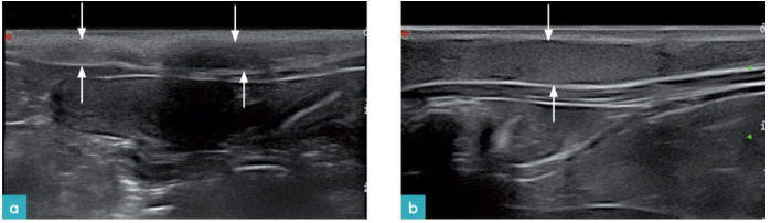一只刚生产不久的猫的腹中部长轴观。