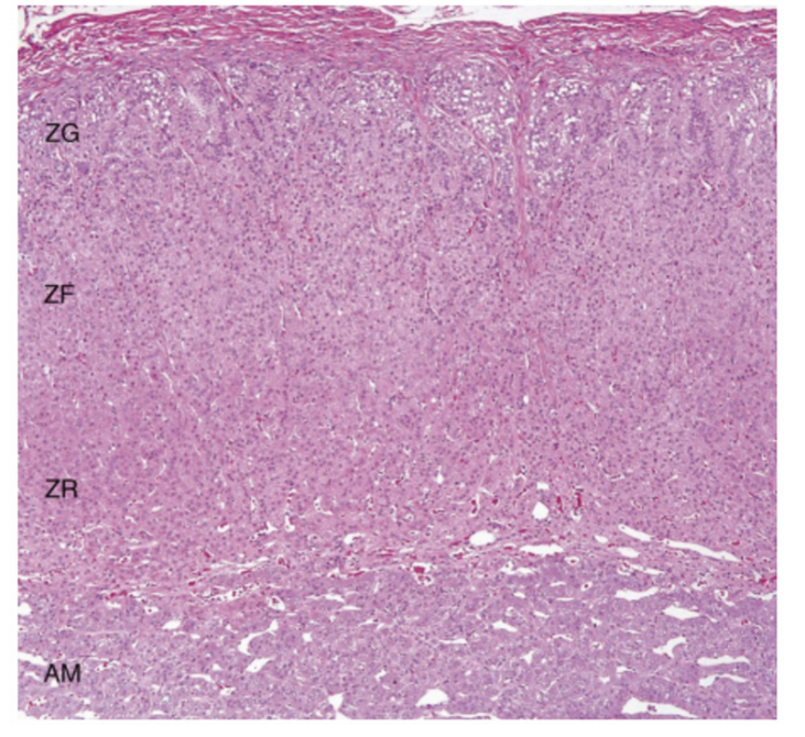 图显示肾上腺皮质三层的正常肾上腺组织病理学。AM,肾上腺髓质;ZF,带状束状;ZG,球状带;ZR,网状带。 图显示肾上腺皮质三层的正常肾上腺组织病理学。AM,肾上腺髓质;ZF,带状束状;ZG,球状带;ZR,网状带。