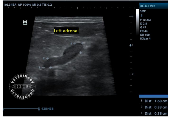 图一只犬左肾上腺的超声图像长度(测量值1):1.6cm;头侧厚度(测量值2):0.33cm;尾极厚度 (测量值3)0.38cm。 图一只犬左肾上腺的超声图像长度(测量值1):1.6cm;头侧厚度(测量值2):0.33cm;尾极厚度 (测量值3)0.38cm。