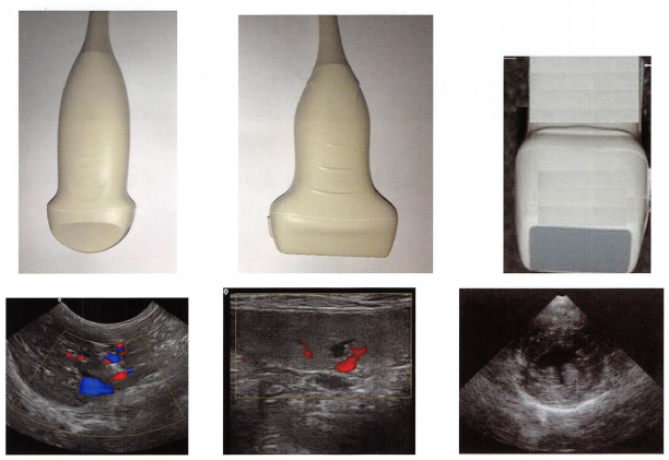 左:腹部微凸阵探头与其所呈现的图像、中:线阵探头与图像、右:心脏探头(相控阵探头)与图像。
