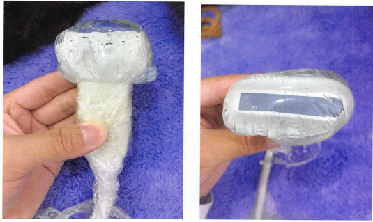 用辐合剂禾口保鲜膜自制的增距垫