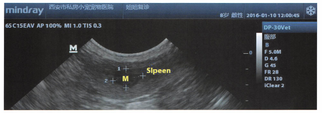 子宫蓄脓患犬超声偶然发现脾脏低回声结节,FNA细胞学证实为结节增生。 子宫蓄脓患犬超声偶然发现脾脏低回声结节,FNA细胞学证实为结节增生。