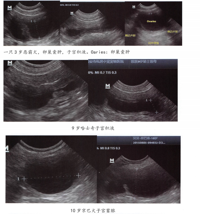 子宫积液超声影像图 子宫积液超声影像图